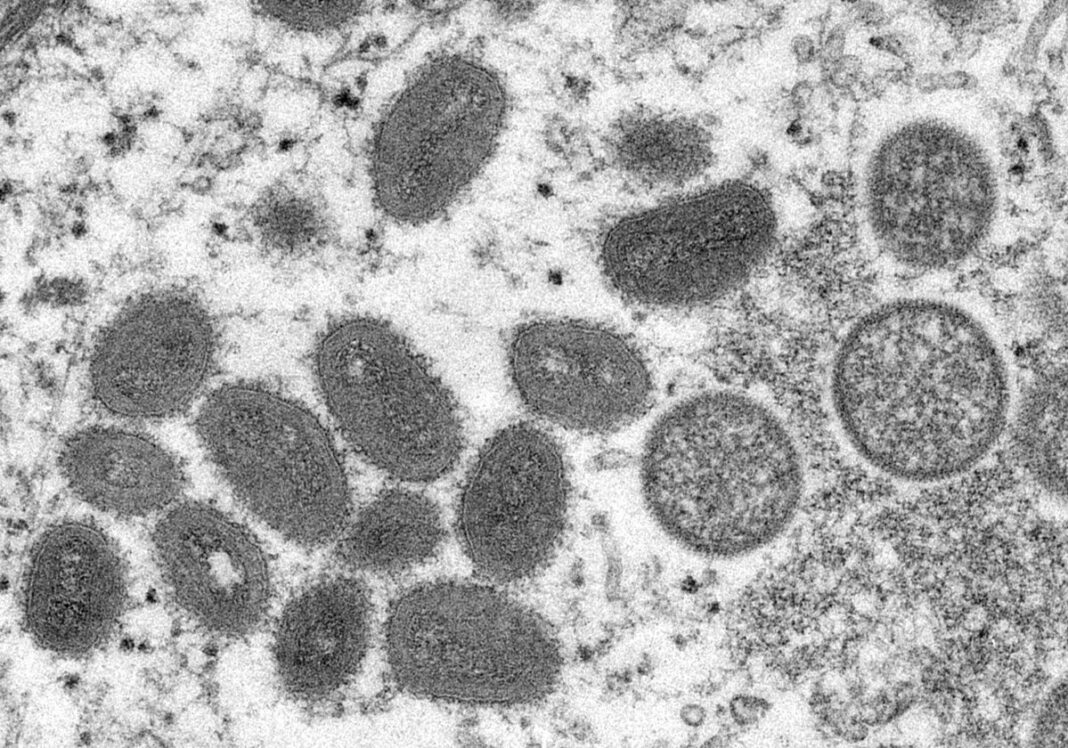 Image of monkeypox virions