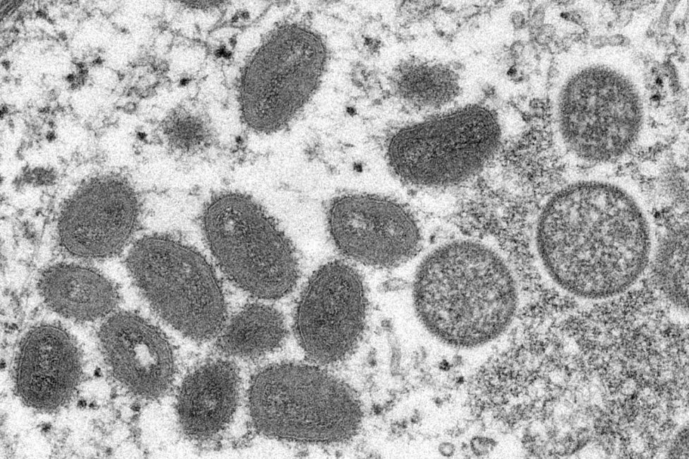 Image of monkeypox virions